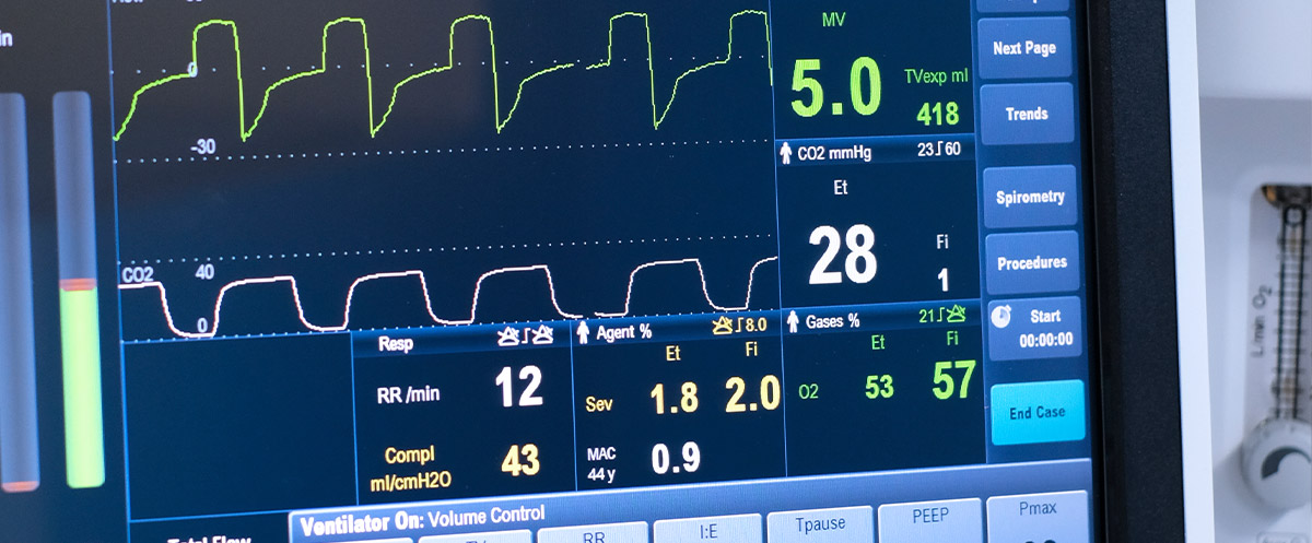 Sedation monitoring