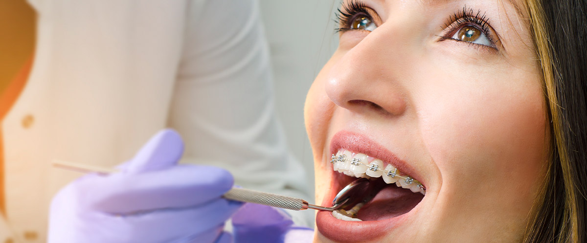 Woman with braces Woman with braces
